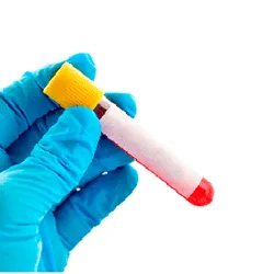 Determinación de grupo sanguineo