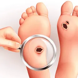 SERVICIO PIE DIABÉTICO