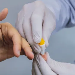 Determinació de paràmetres biològics: Perfil Lipídic