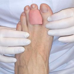 ORTESIS DE SILICONA A MEDIDA