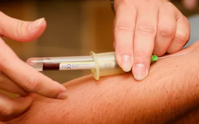 Medici&oacute;n de colesterol y triglic&eacute;ridos