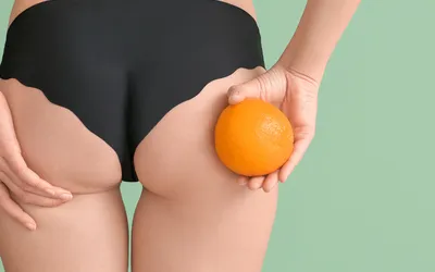 Stop Cel&middot;lulitis