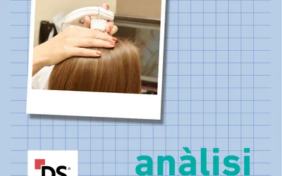 An&agrave;lisi capil.lar