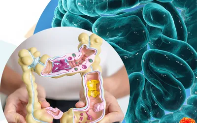 Programa de detecció del càncer de colon