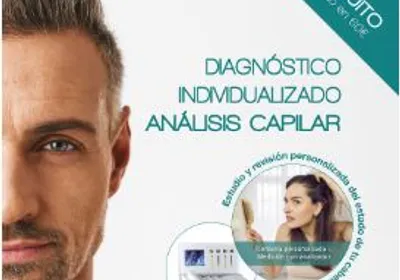 An&agrave;lisi capil&middot;lar