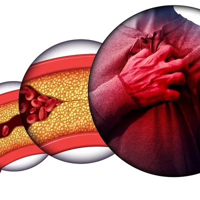 Anàlisi perfil lipídic