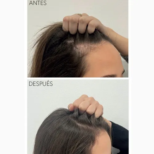 MONCHO MORENO TRATAMIENTO RAPUNHAIR 70ML