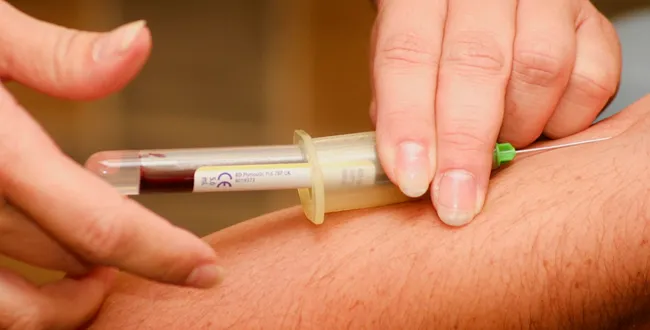 Medici&oacute;n de colesterol y triglic&eacute;ridos