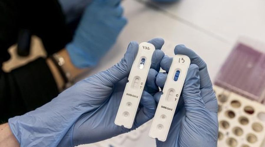 El nuevo test de orina que te permite saber si has pasado el coronavirus y si tienes anticuerpos