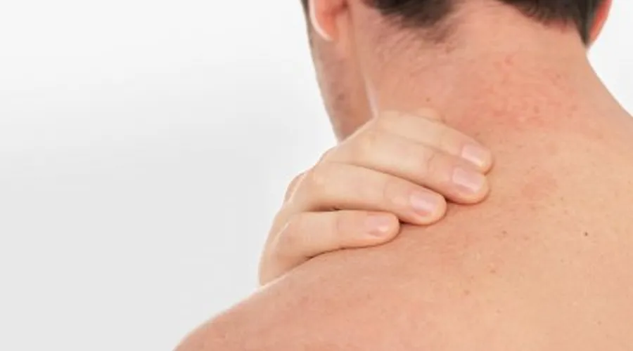 Día Mundial de Dermatitis Atópica