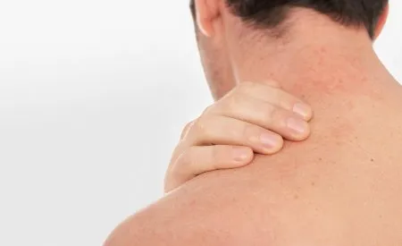 Día Mundial de Dermatitis Atópica